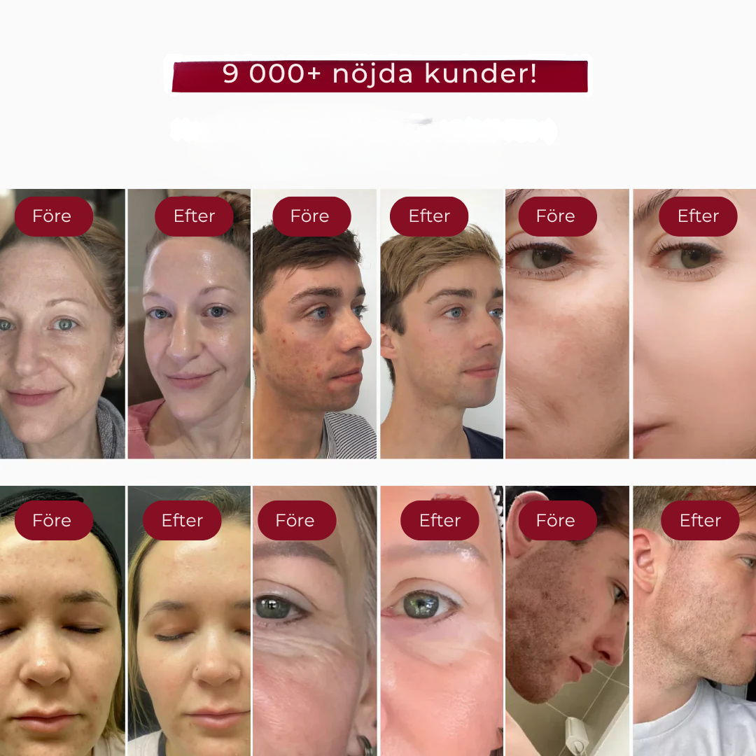 LysaSkin™ - Naturlig. Klar. Vacker.