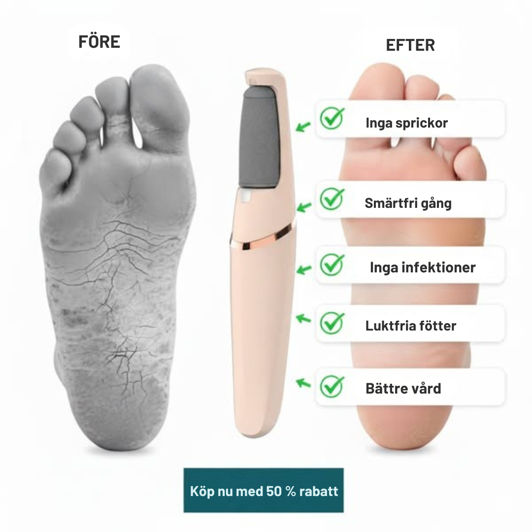 Elektriska Fotfilen™ - Bekvämt, snabbt & smärtfritt
