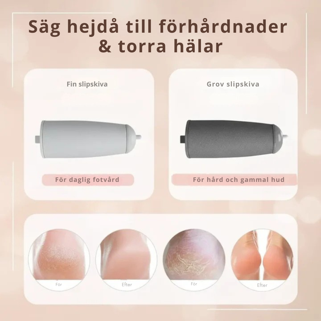 Elektriska Fotfilen™ - Bekvämt, snabbt & smärtfritt
