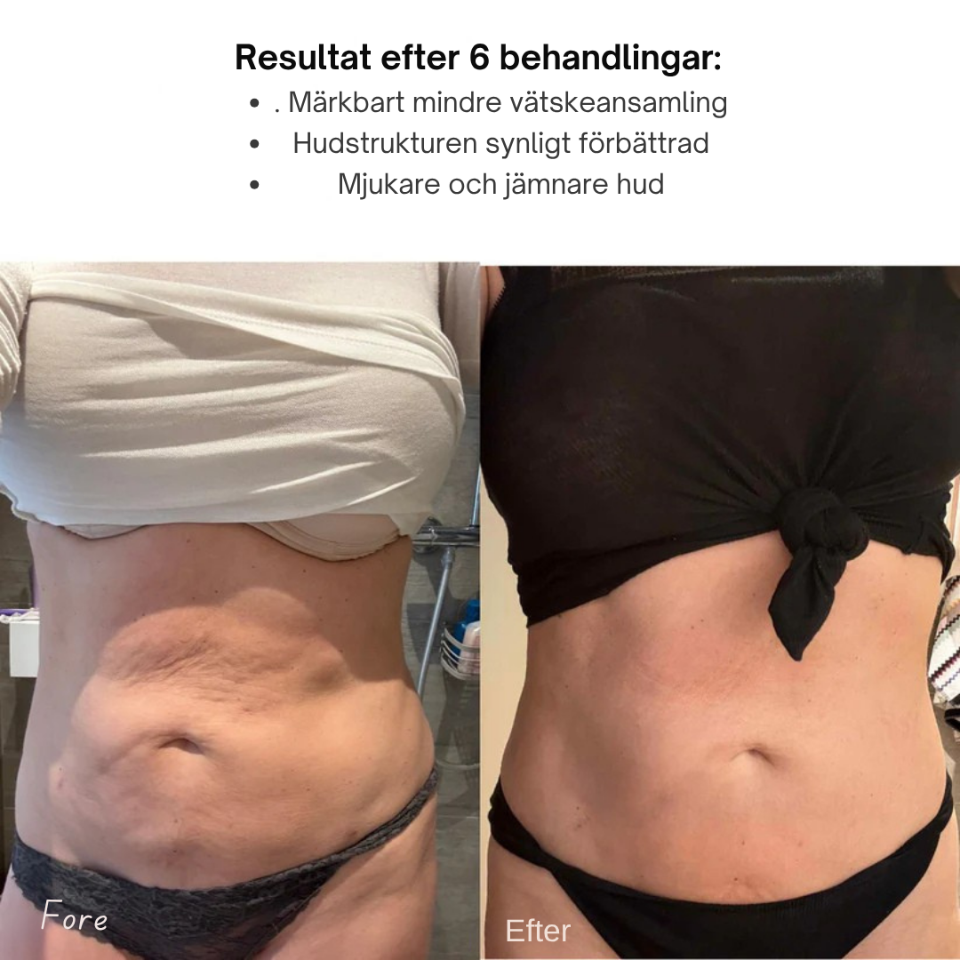 SkönHud™ | Slät, stark, strålande.