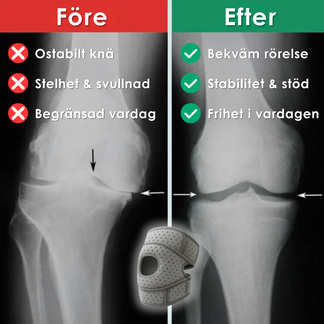OrthoCare Knee™– För en vardag utan knäsmärta