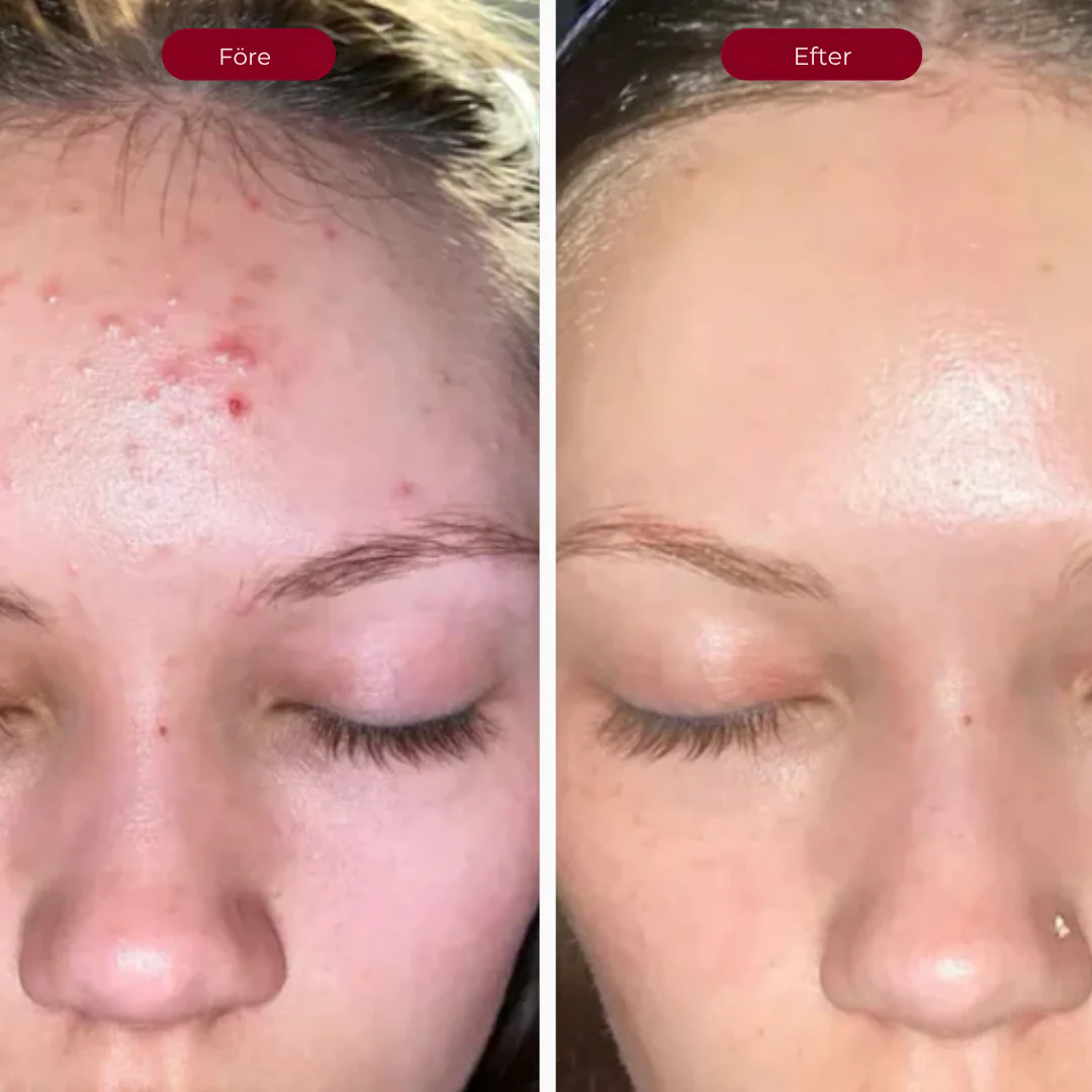 LysaSkin™ - Naturlig. Klar. Vacker.