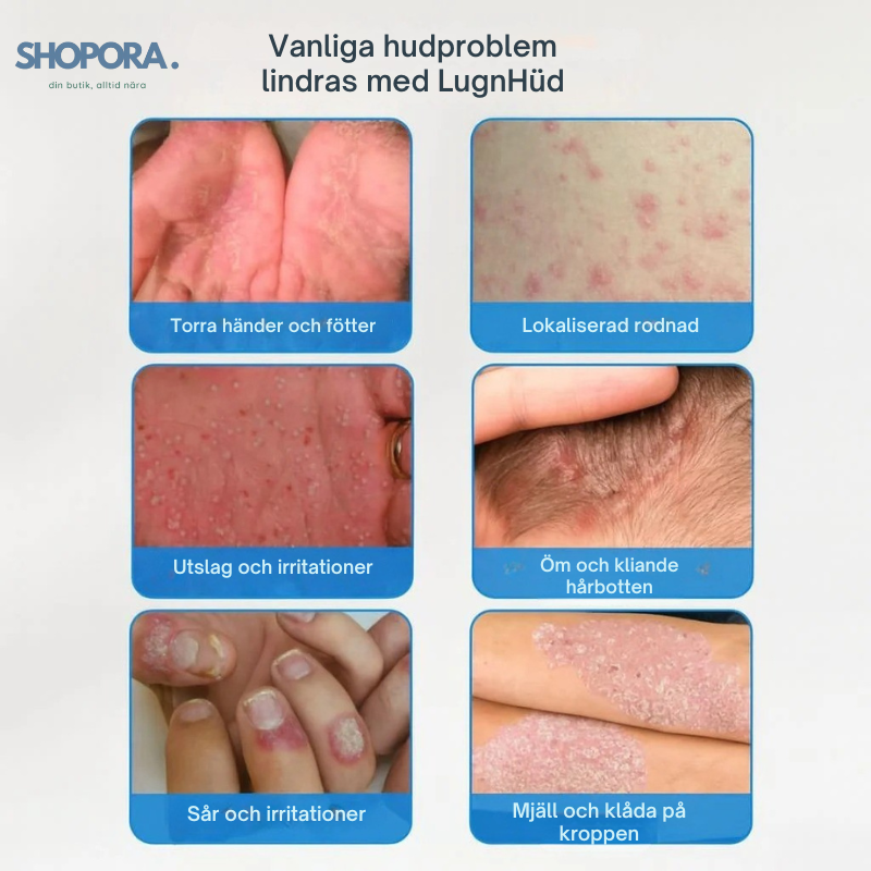 LugnHüd™ – Lugnar, skyddar och återställer balansen