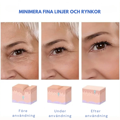 LiftSerum™ Pro | Släta. Strama. Lysa.