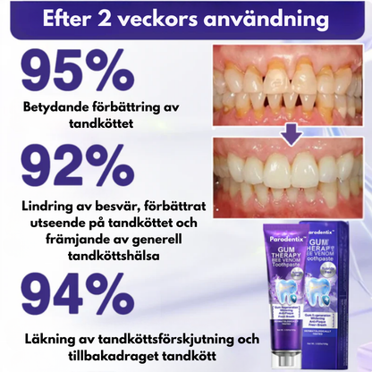 Parodentix™ | Naturlig vård för starkare tandkött