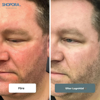 LugnHüd™ – Lugnar, skyddar och återställer balansen