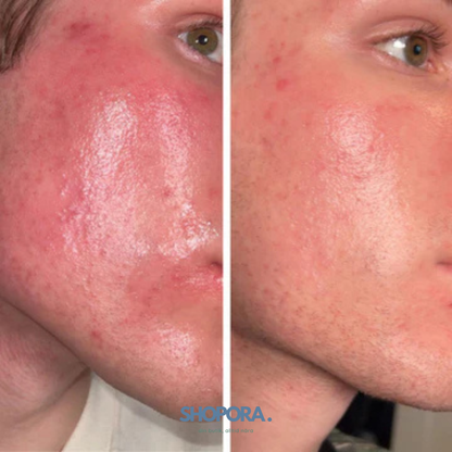 LumiInfra™ Mask | Ungdom. Lyster. Balans.