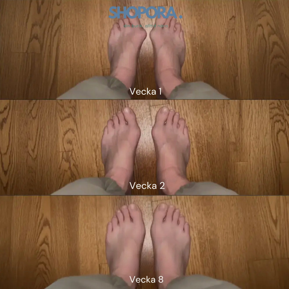 HalluxCare™ | Stödjer. Lindrar. Stärker.